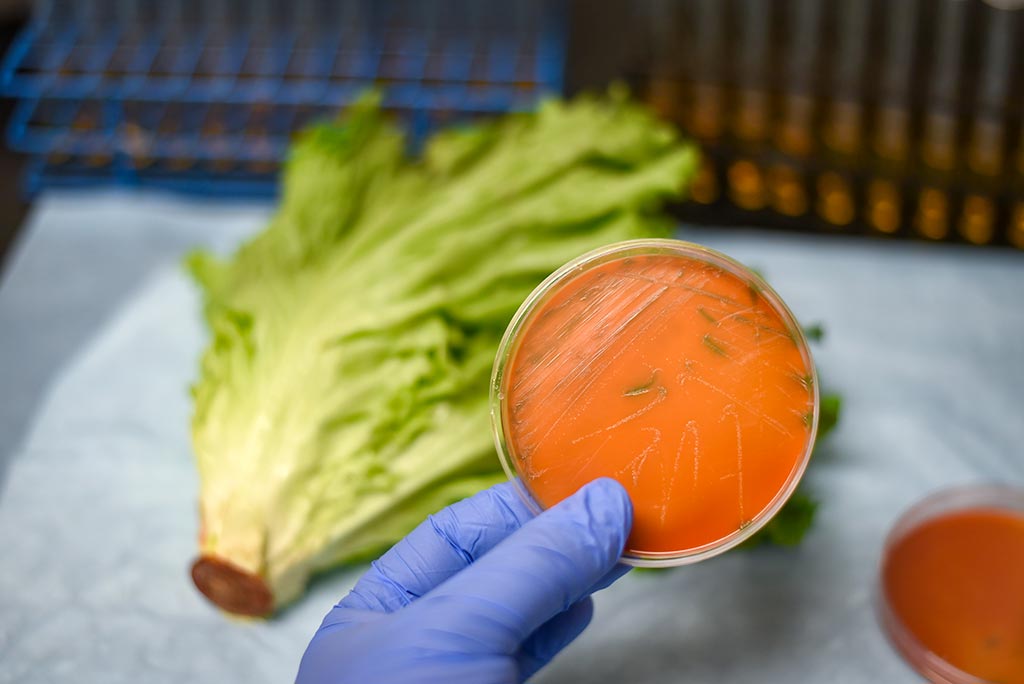 Listeria bacterial culture in petri dish