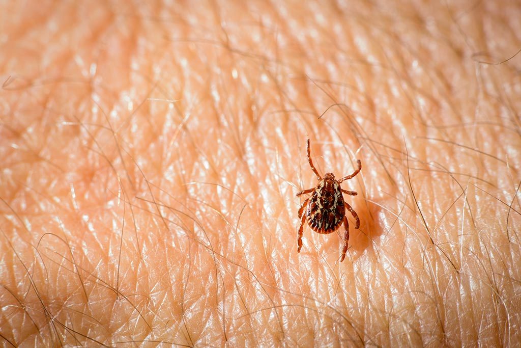 A dog tick, Dermacentor variabilis, walks on human skin looking for a location to feed.