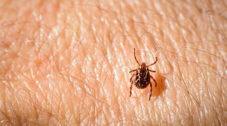A dog tick, Dermacentor variabilis, walks on human skin looking for a location to feed.