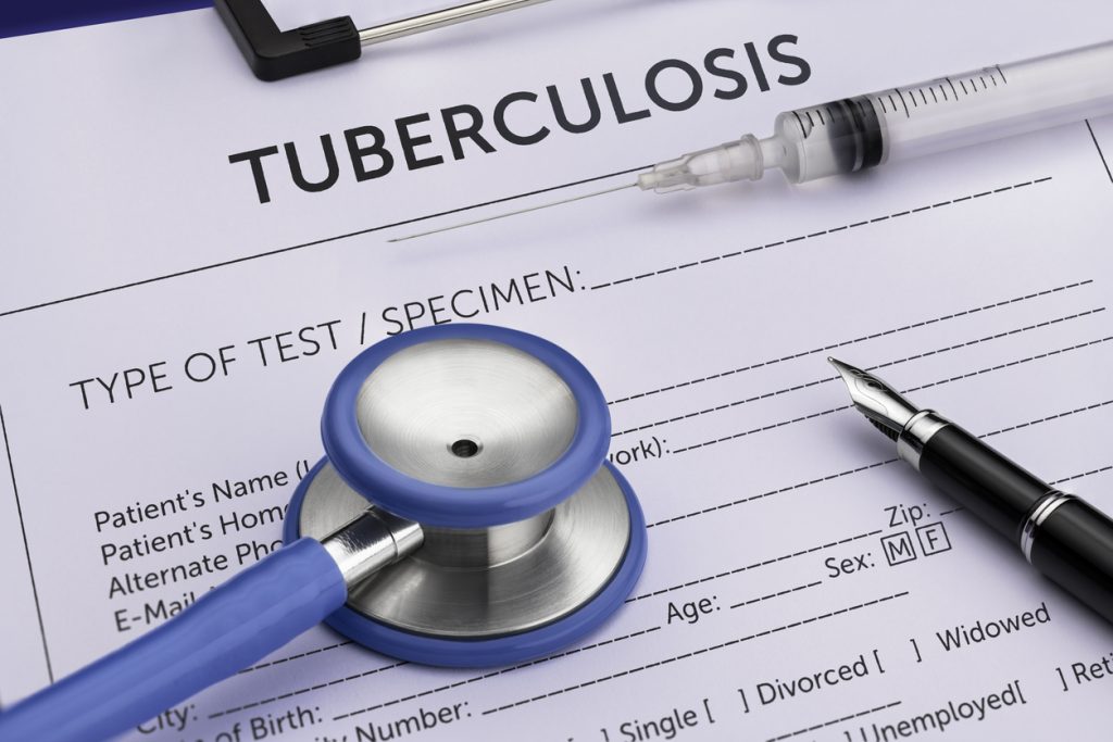 Tuberculosis Bacterium, Healthcare And Medicine, Medical Test, Vaccination, Syringe.